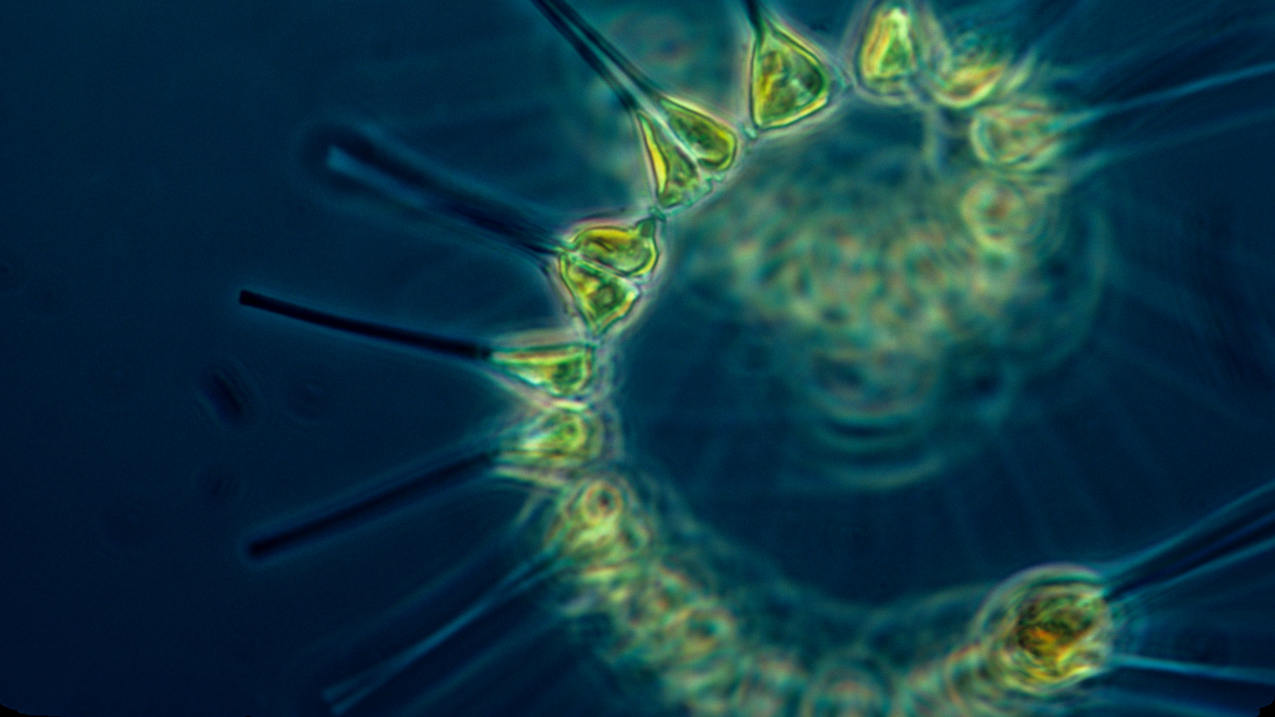 A photo taken through a microscope of phytoplankton.