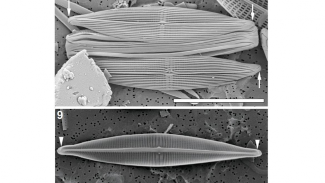 This microscope image of a newly discovered species of diatom -- or micro-algae -- is named for NOAA scientist Dr. Joan Browder.