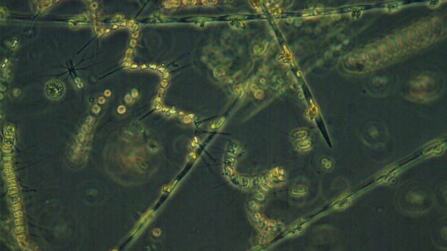 Phytoplankton communities collected during the NOAA Fisheries September 2019 Northern California Current Ecosystem Cruise. Large type Psuedo-nitzchia chains look like grains of rice, while Asterionellopsisglacialis and Chaetoceros debilis are in spiral chains. This image shows a magnified view of phytoplankton communities: large type Psuedo-nitzchia chains look like grains of rice, while Asterionellopsisglacialis and Chaetoceros debilis are in spiral chains. 