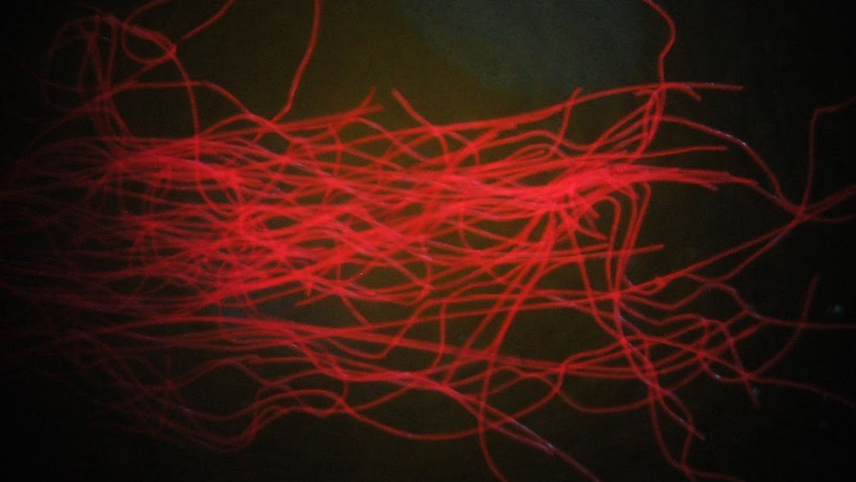 Red fibers are illuminated against a black background. 