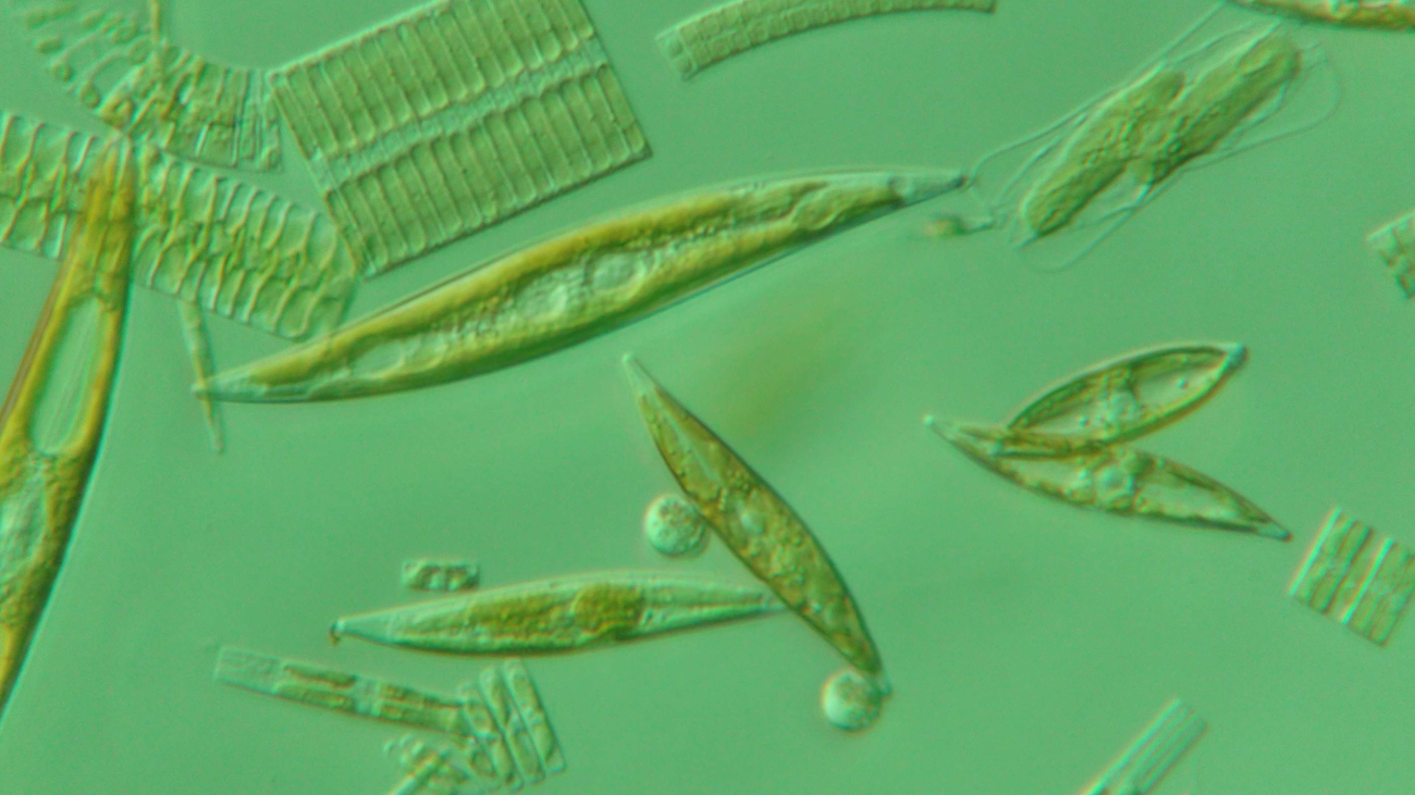 A microscopic view of ice algae