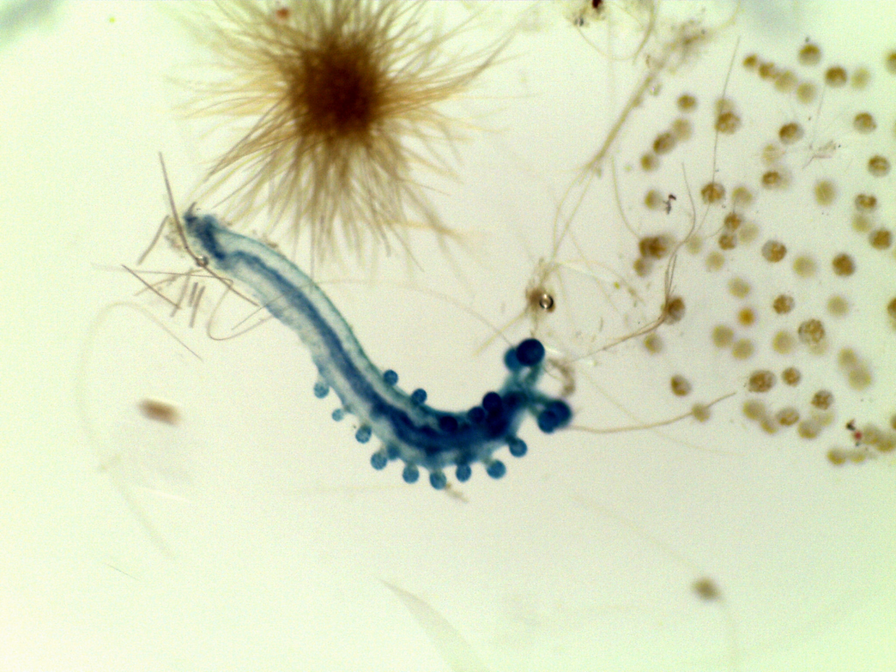Various small planktonic life forms seen under the microscope