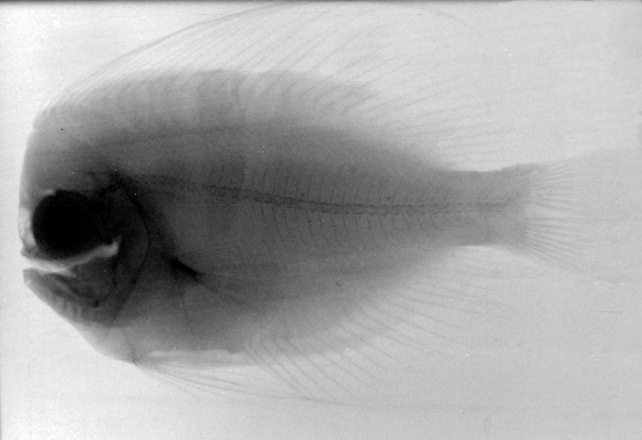 An X-ray of a Bigmouth Manefish 