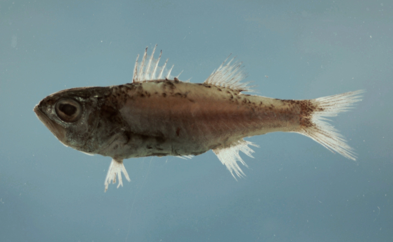 First dorsal serrations of a keelcheek bass (Synagrops spinosus )