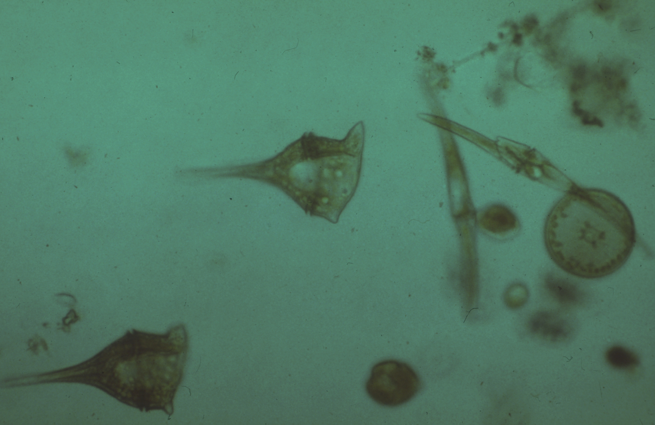 Zooplankton - 1/5 inch worm plankton