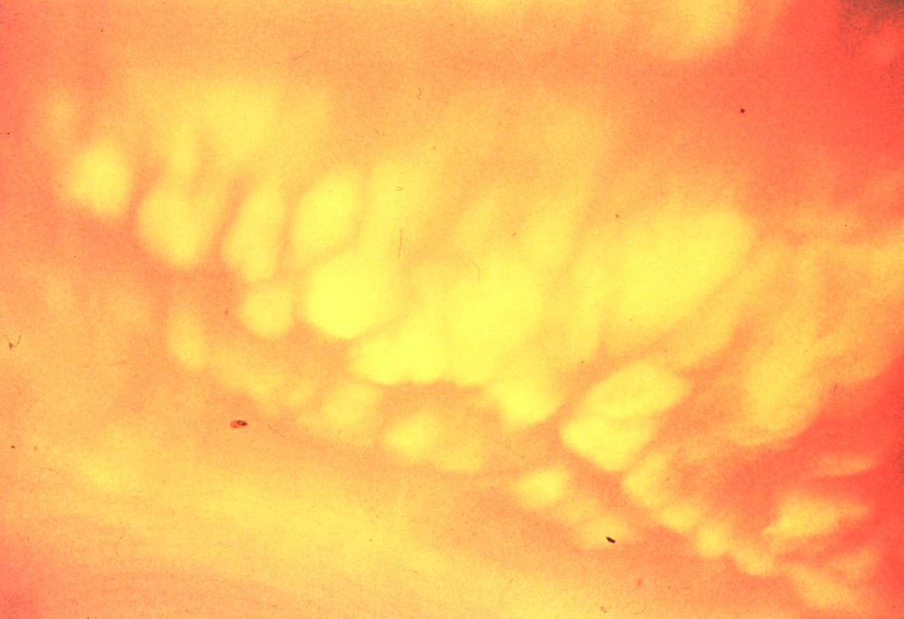 Globular mammatus clouds with radar in foreground