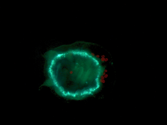 Unknown medusa-like plankton