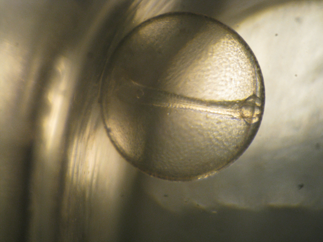 Through the microscope - unknown egg