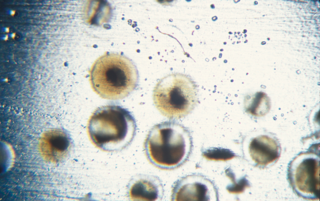 Fish eggs seen under the microscope