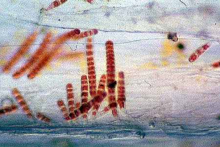Microscopic view of young porphyra algae being cultured by students at theBridgeport Regional Vocational Aquaculture School in Bridgeport, Connecticut