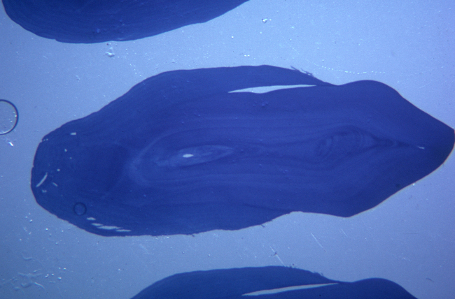 A cross-section of a fur seal tooth, under a microscope