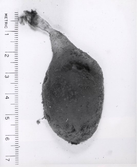 Egg capsule of the lugworm (Arenicola cristata) from Tampa Bay