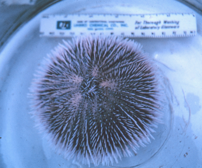 Sea urchin, dorsal view