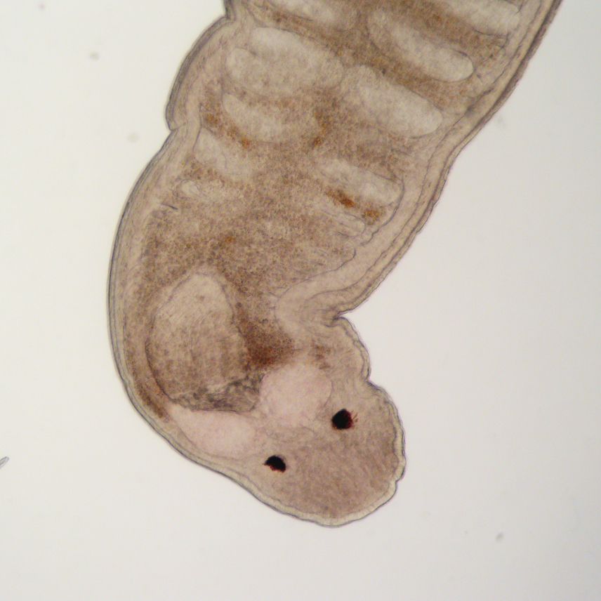 A photo taken through a microscope. The worm is reminiscent of a flatworm, but more globular in appearance. It has two dark pigmented eye spots.